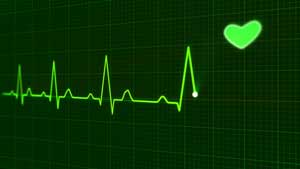 Arrêt cardiaque, électrocardiogramme 2